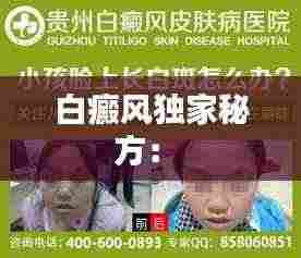 白癜风独家秘方： 