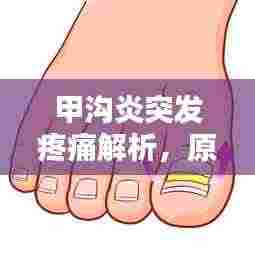甲沟炎突发疼痛解析,原因、防治策略全攻略